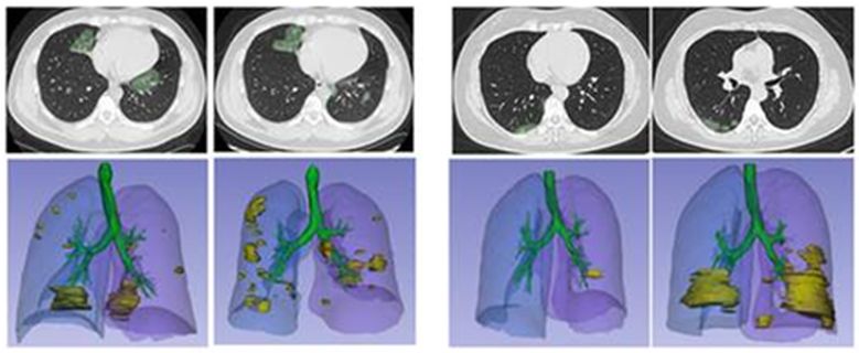 COVID-19 diagnostics